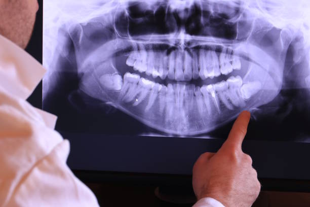 Best Walk-In Emergency Dentist in Snyderville, UT